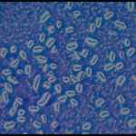 Bacteria with capsules
