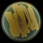 Bacteria colonies on agar culture plate