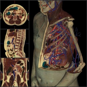 online dissection