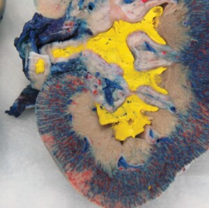 preserved injection