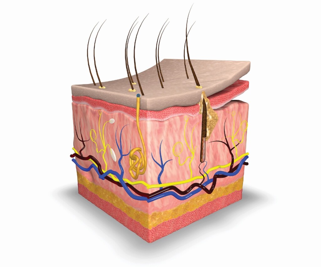 skin model