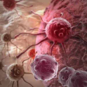 cancer cell