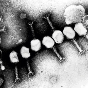 e.coli