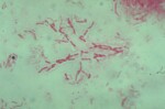 bacillus subtilis (rods)