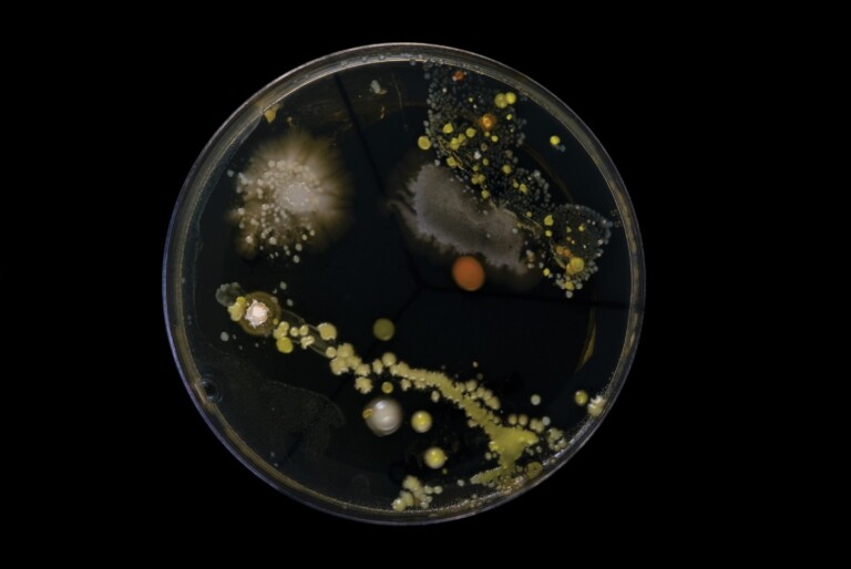 microbiology culture