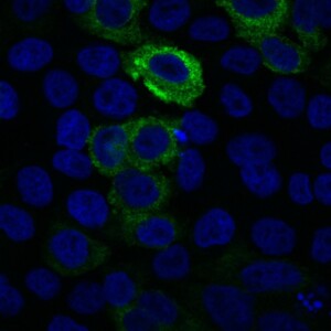gfp_dapi