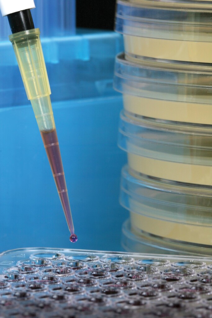 electrophoresis kits