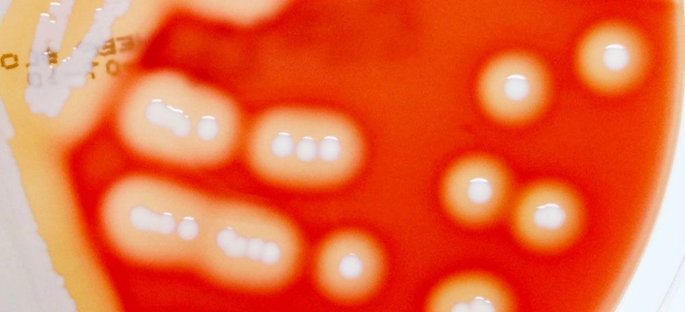 blood_agar
