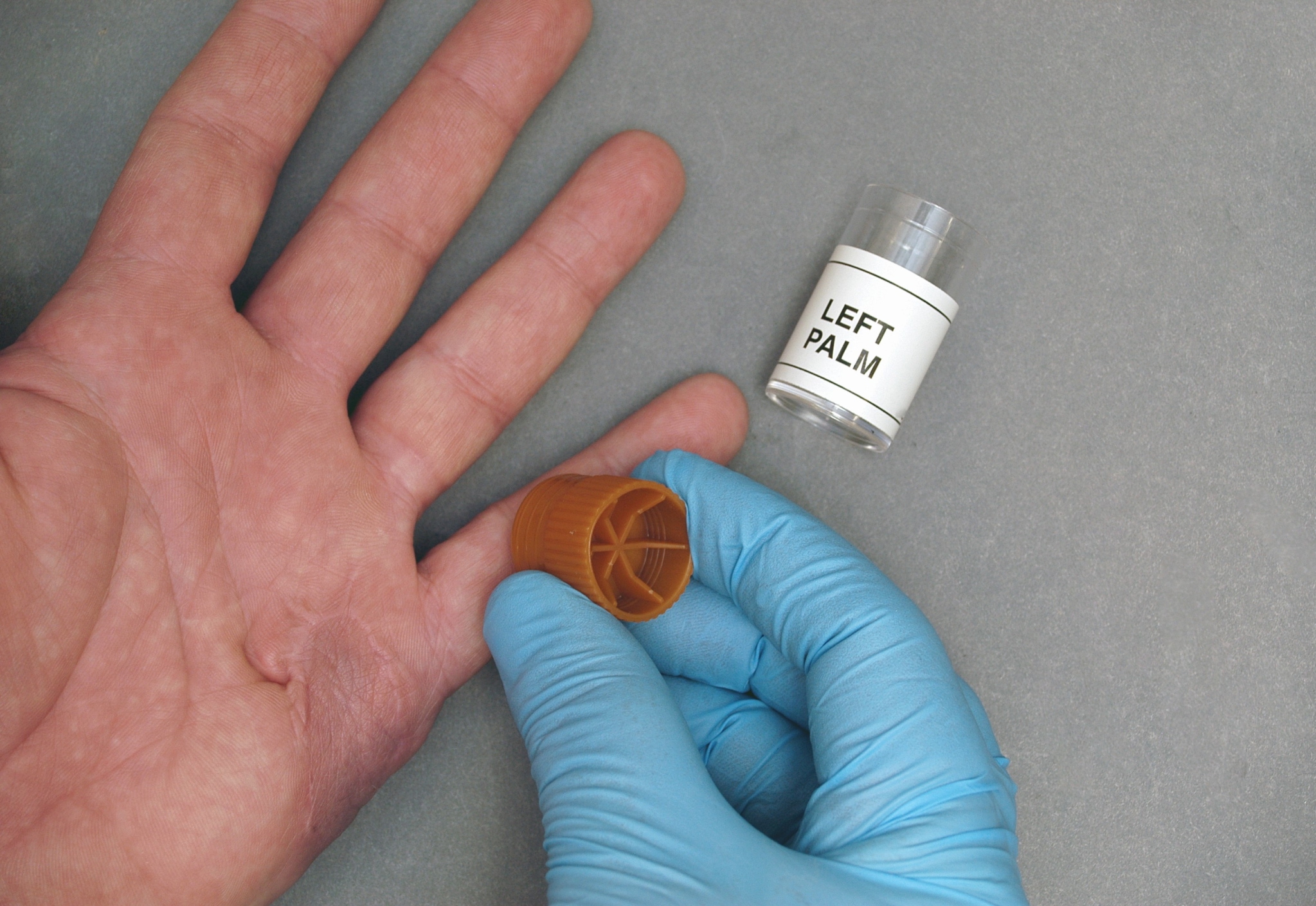 GSR (gun shot residue) test being conducted on a murder suspect's left hand.