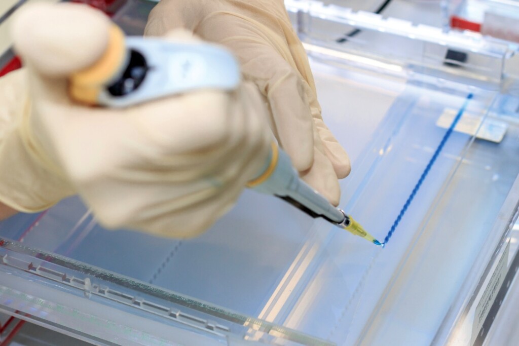 Pipetting gel for electrophoresis.