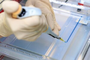 Pipetting gel for electrophoresis.