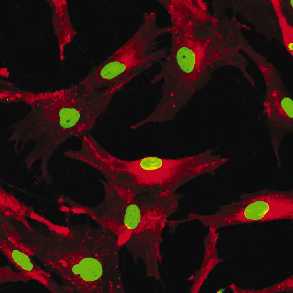 Mesenchymal stem cells labeled with fluorescent molecules