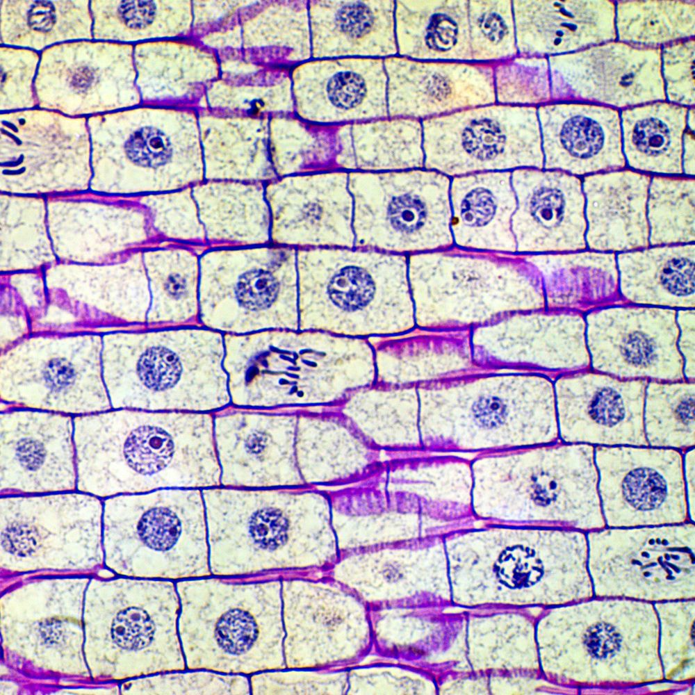 Onion cells undergoing mitosis