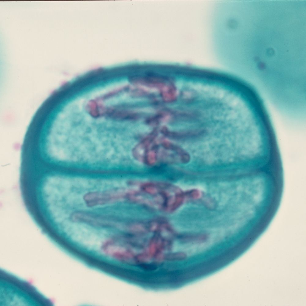 Stained lily anther viewed under a microscope showing a phase of meiosis