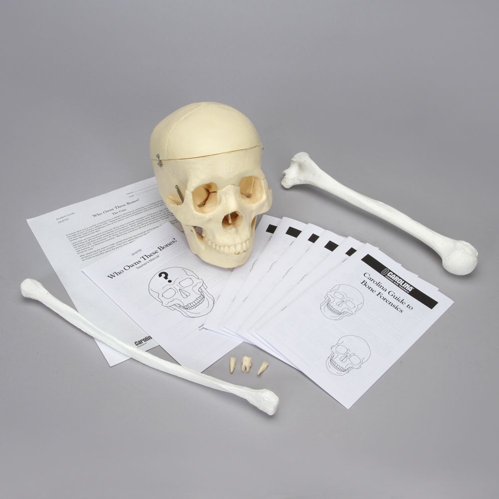 skull [with 3 removable teeth], arm bone, and leg bone