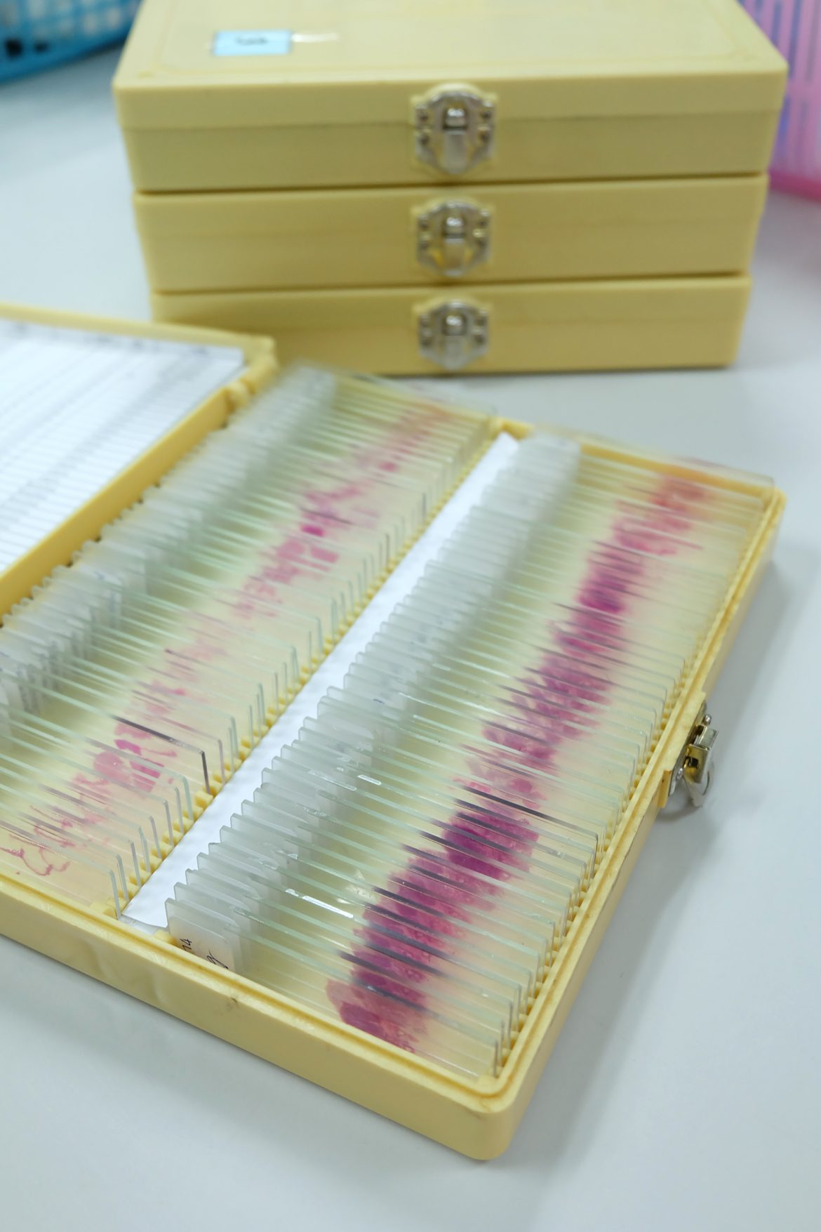 Histology slides in a box.