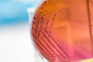 Anaerobic bacteria plated.