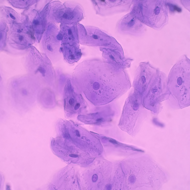 Human epithelial cheek cells