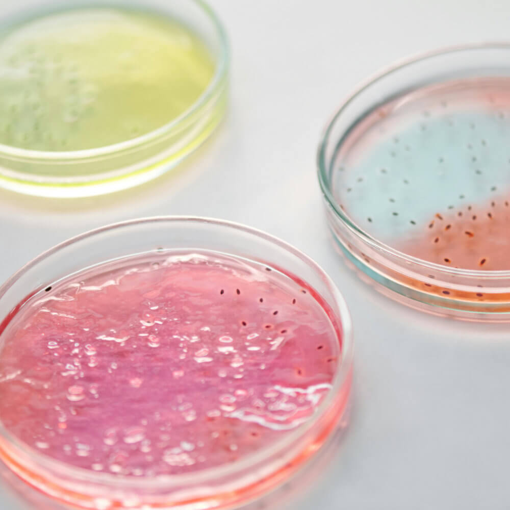 bacteria