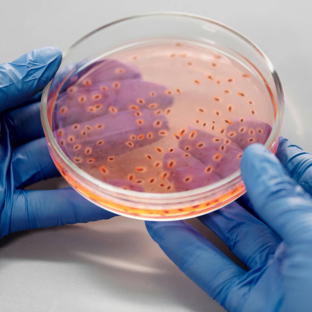 bacteria2