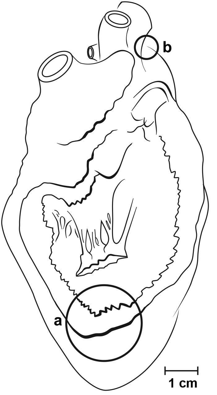 heart drawing