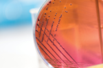 ecoli
