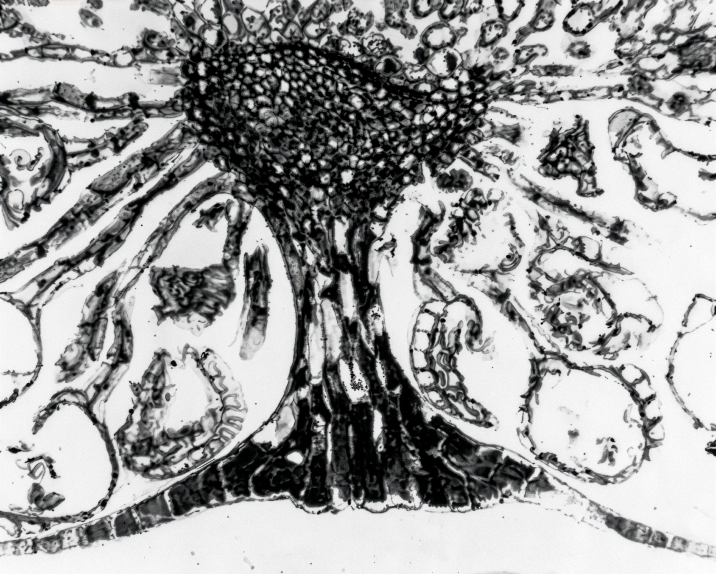FIGURE 10 Sorus of Christmas fern l.s.