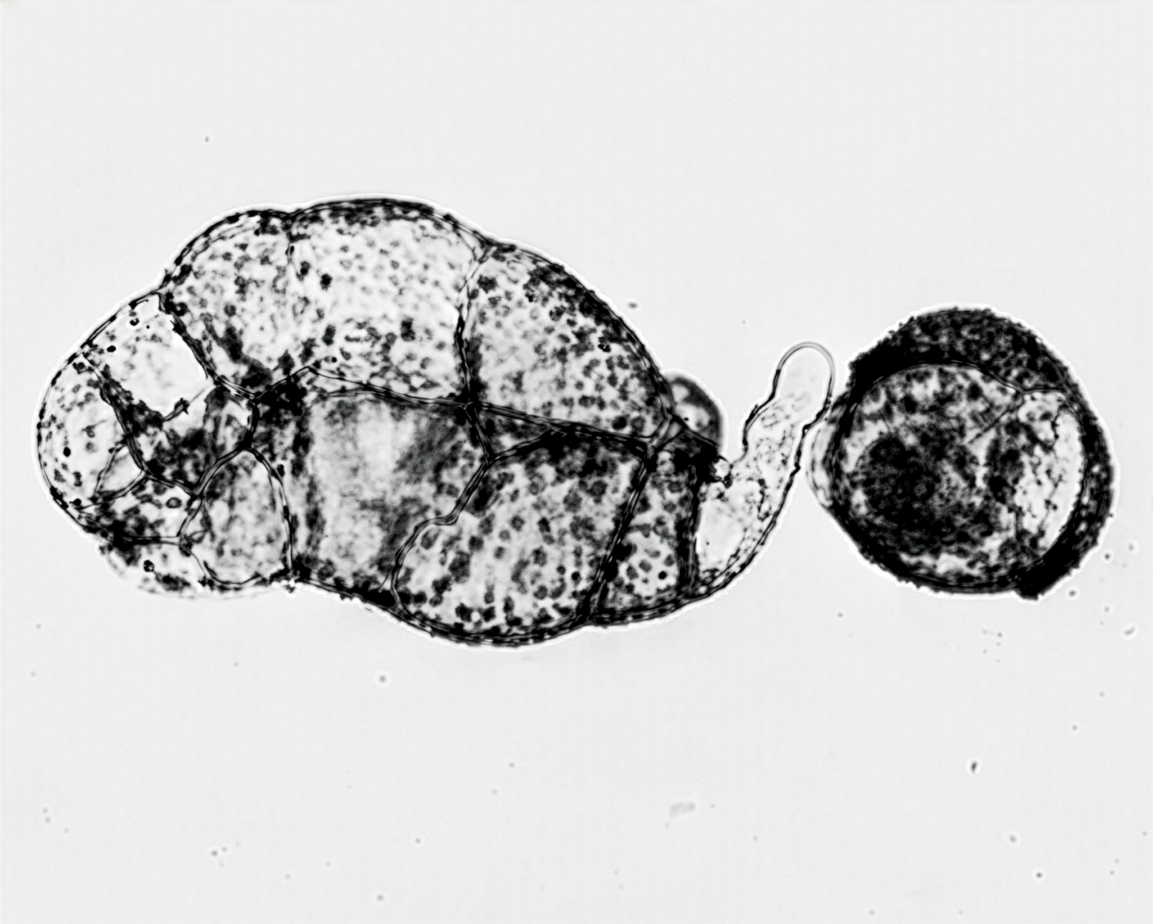 FIGURE 12 Young prothallium of Woodwardia.