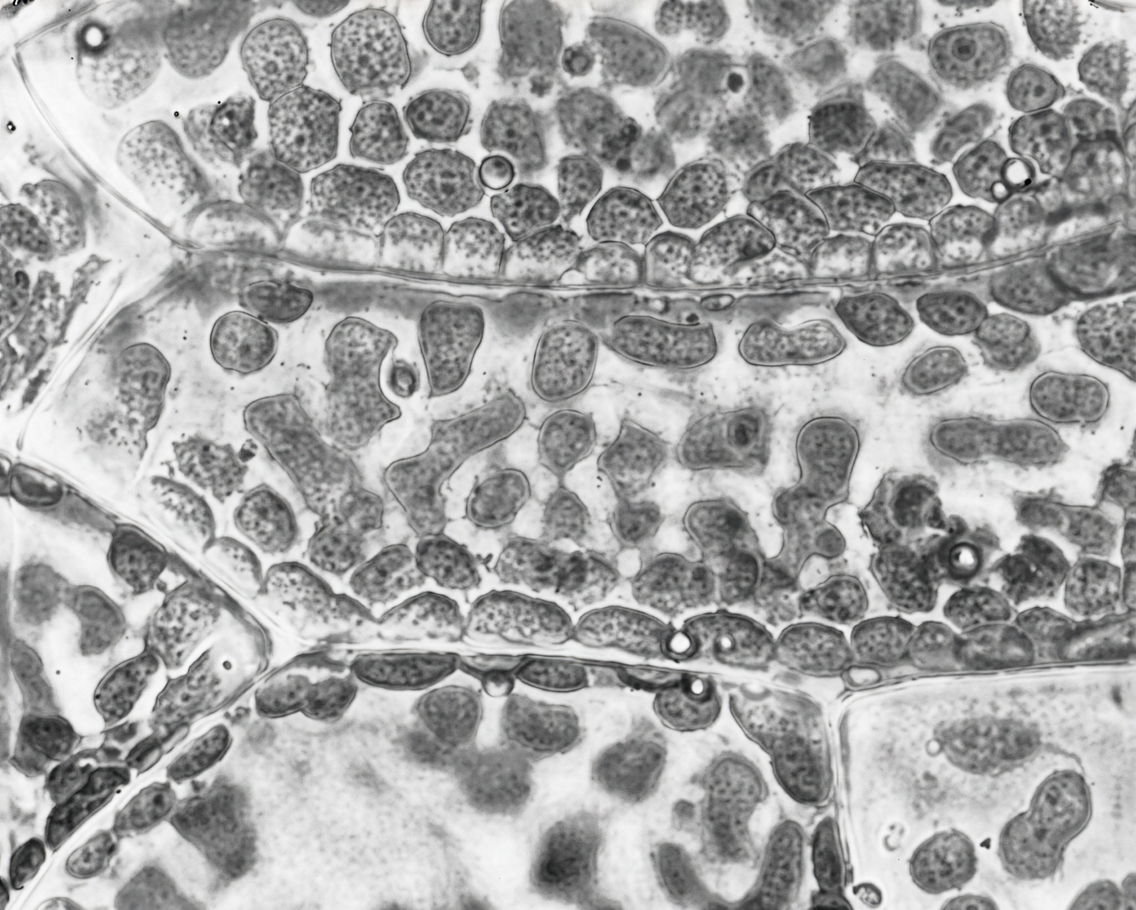 FIGURE 14 Chloroplasts in prothallial cells.
