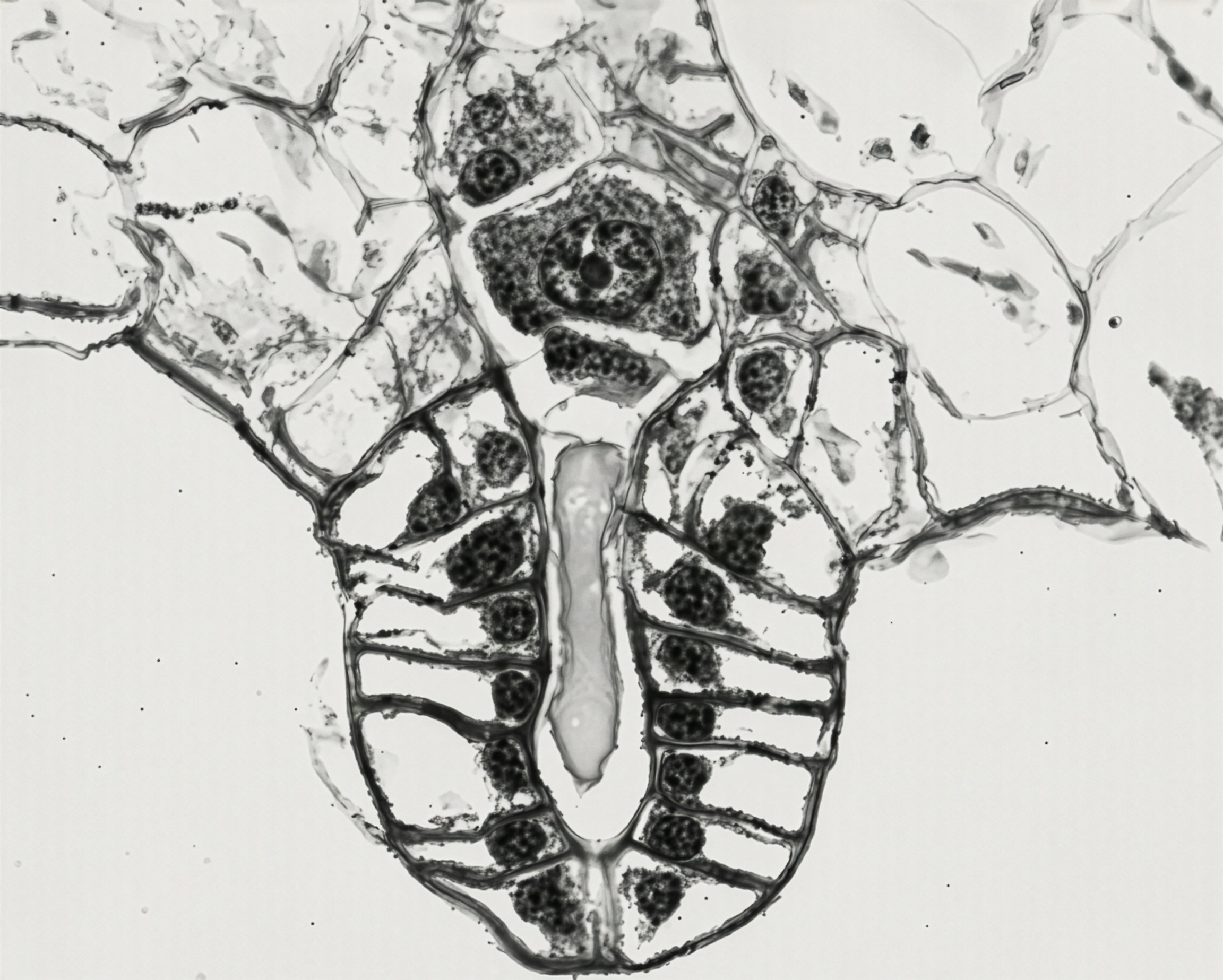 FIGURE 15 Archegonium of Osmunda, l.s.
