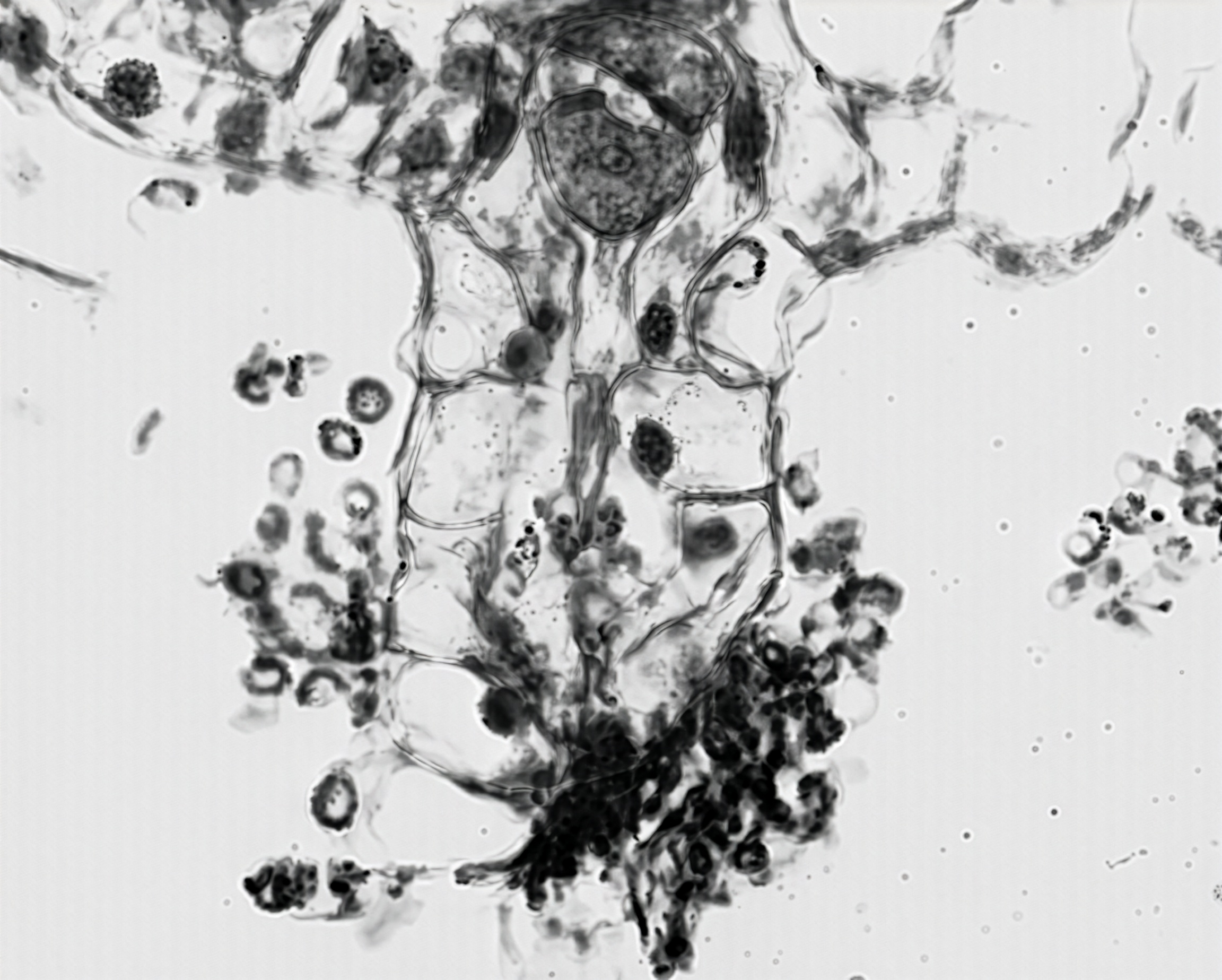 FIGURE 18 Fertilization in Woodwardia, l.s.