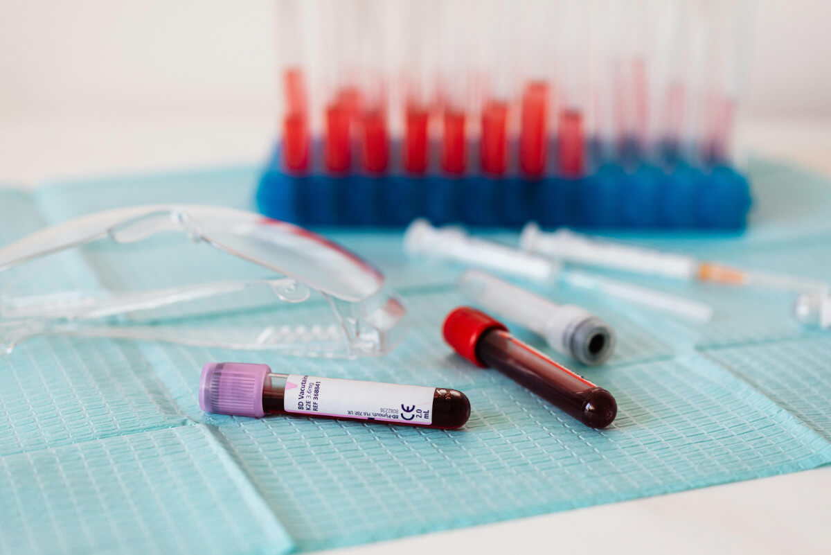 Blood typing