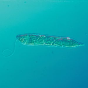 151351 Euglena Culture, Living